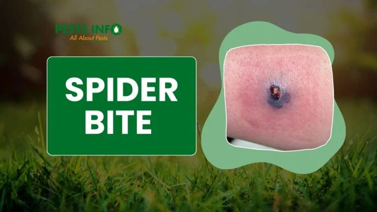 Why You Should NEVER Squeeze Pus from a Spider Bite
